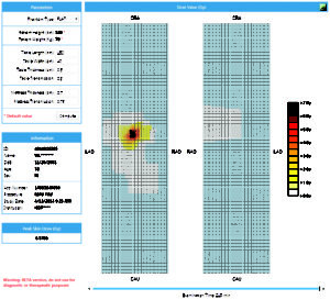 2D Skin dose