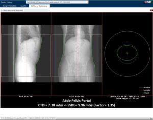 Patient ISO center